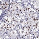 PHOX2A Antibody in Immunohistochemistry (Paraffin) (IHC (P))