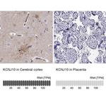 Kir4.1 (KCNJ10) Antibody