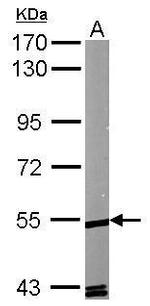 RORA Antibody in Western Blot (WB)