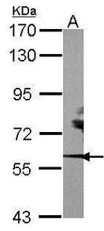 RORA Antibody in Western Blot (WB)