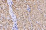 Alpha-Smooth Muscle Actin Antibody in Immunohistochemistry (Paraffin) (IHC (P))