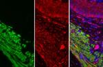 Alpha-Smooth Muscle Actin Antibody in Immunohistochemistry (Paraffin) (IHC (P))