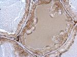 alpha-1a Adrenergic Receptor Antibody in Immunohistochemistry (Paraffin) (IHC (P))