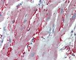 alpha-1a Adrenergic Receptor Antibody in Immunohistochemistry (Paraffin) (IHC (P))