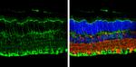 Cannabinoid Receptor 1 Antibody in Immunohistochemistry (Paraffin) (IHC (P))