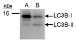 LC3B Antibody in Western Blot (WB)