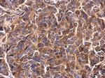 Survivin Antibody in Immunohistochemistry (Paraffin) (IHC (P))