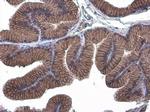 E-cadherin Antibody in Immunohistochemistry (Paraffin) (IHC (P))