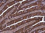 E-cadherin Antibody in Immunohistochemistry (Paraffin) (IHC (P))