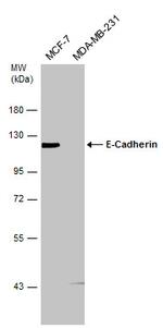 E-cadherin Antibody in Western Blot (WB)