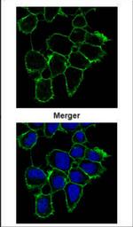 EGFR Antibody in Immunocytochemistry (ICC/IF)