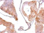 EGFR Antibody in Immunohistochemistry (Paraffin) (IHC (P))