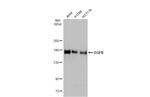 EGFR Antibody in Western Blot (WB)