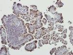 MDM2 Antibody in Immunohistochemistry (Paraffin) (IHC (P))