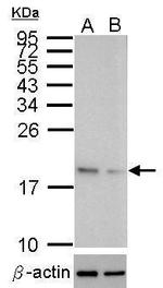 SOD1 Antibody in Western Blot (WB)