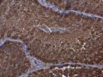 WT1 Antibody in Immunohistochemistry (Paraffin) (IHC (P))