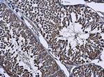 WT1 Antibody in Immunohistochemistry (Paraffin) (IHC (P))