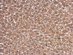 WT1 Antibody in Immunohistochemistry (Paraffin) (IHC (P))