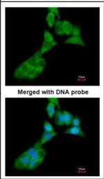 MMP3 Antibody in Immunocytochemistry (ICC/IF)