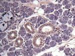 MMP3 Antibody in Immunohistochemistry (Paraffin) (IHC (P))