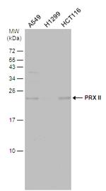 PRDX2 Antibody in Western Blot (WB)