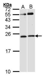 Phospho-RAC1/CDC42 (Ser71) Antibody in Western Blot (WB)