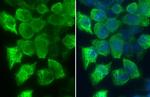 Phospho-RAC1/CDC42 (Ser71) Antibody in Immunocytochemistry (ICC/IF)