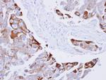 Phospho-RAC1/CDC42 (Ser71) Antibody in Immunohistochemistry (Paraffin) (IHC (P))