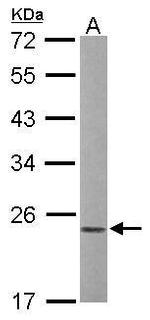 Phospho-RAC1/CDC42 (Ser71) Antibody in Western Blot (WB)