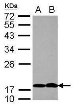 PTHLH Antibody in Western Blot (WB)