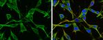 GFAP Antibody in Immunocytochemistry (ICC/IF)