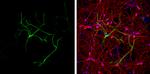 GFAP Antibody in Immunocytochemistry (ICC/IF)