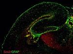 GFAP Antibody in Immunohistochemistry (Frozen) (IHC (F))