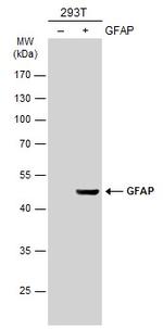 GFAP Antibody in Western Blot (WB)