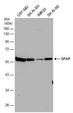 GFAP Antibody in Western Blot (WB)