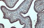 B-Raf Antibody in Immunohistochemistry (Paraffin) (IHC (P))