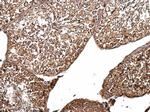 B-Raf Antibody in Immunohistochemistry (Paraffin) (IHC (P))