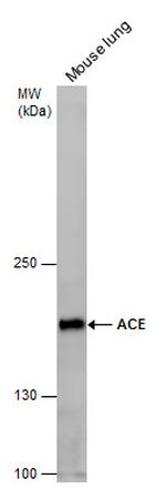 ACE Antibody in Western Blot (WB)