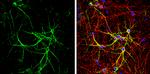 E6AP Antibody in Immunocytochemistry (ICC/IF)