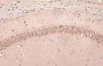 E6AP Antibody in Immunohistochemistry (Paraffin) (IHC (P))