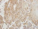 PGP9.5 Antibody in Immunohistochemistry (Paraffin) (IHC (P))