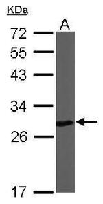 PGP9.5 Antibody in Western Blot (WB)