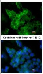 LPL Antibody in Immunocytochemistry (ICC/IF)