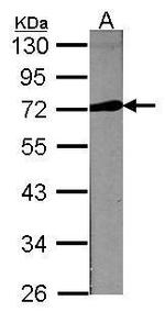 LPL Antibody in Western Blot (WB)