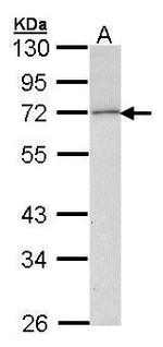 LPL Antibody in Western Blot (WB)