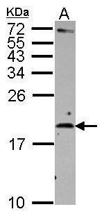 IL-2 Antibody in Western Blot (WB)