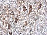 beta Tubulin Antibody in Immunohistochemistry (Paraffin) (IHC (P))