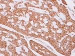 beta Tubulin Antibody in Immunohistochemistry (Paraffin) (IHC (P))