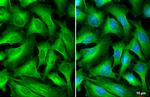 beta Tubulin Antibody in Immunocytochemistry (ICC/IF)