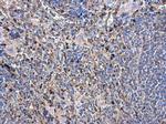 beta Tubulin Antibody in Immunohistochemistry (Paraffin) (IHC (P))